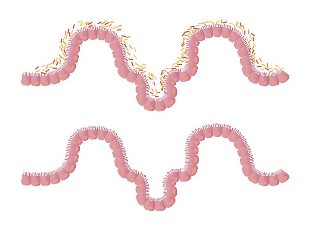 Gut Microbiota